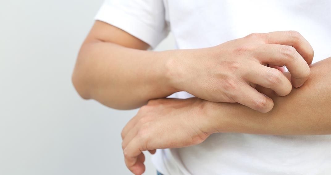 Quelles sont les causes du psoriasis ?