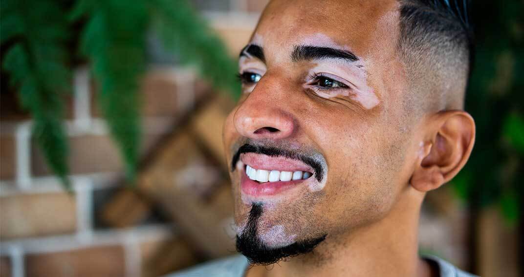 Quelles sont les grandes étapes de la prise en charge du vitiligo ?